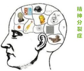 精神分裂癥新機制