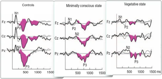 你不知道的認(rèn)知功能測試（P300）！
